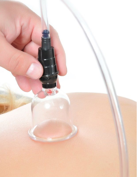 FETISH FANTASY SERIES - SET DE SUCCIÓN 6 PIEZAS: Estimulación Erótica y Juegos Fetichistas