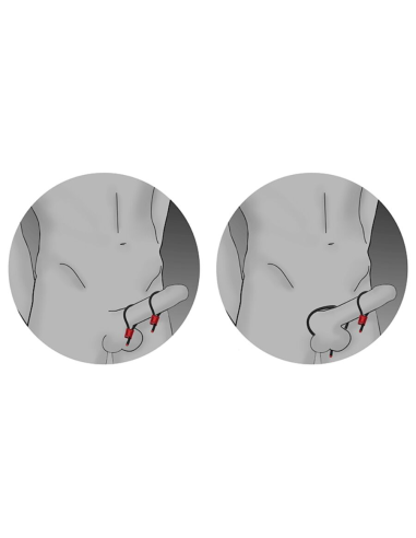 ELECTRASTIM - PRESTIGE ELECTRA LOOPS ANILLOS DE PENE AJUSTABLES NEGRO